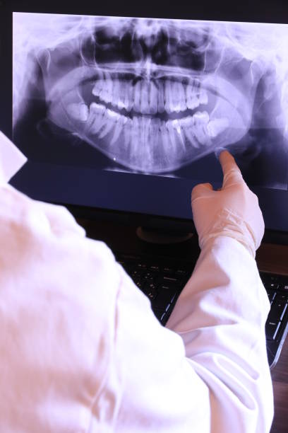 Best Emergency Broken Tooth Repair in Kittitas, WA