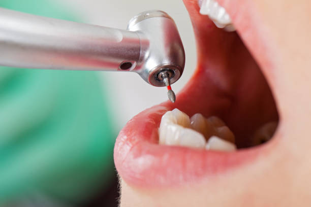 Best Pediatric Emergency Dentist in Kittitas, WA